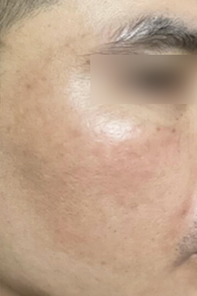 After Image