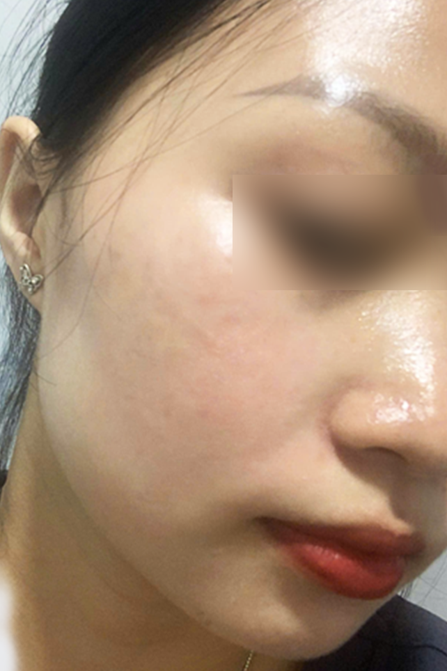 After Image