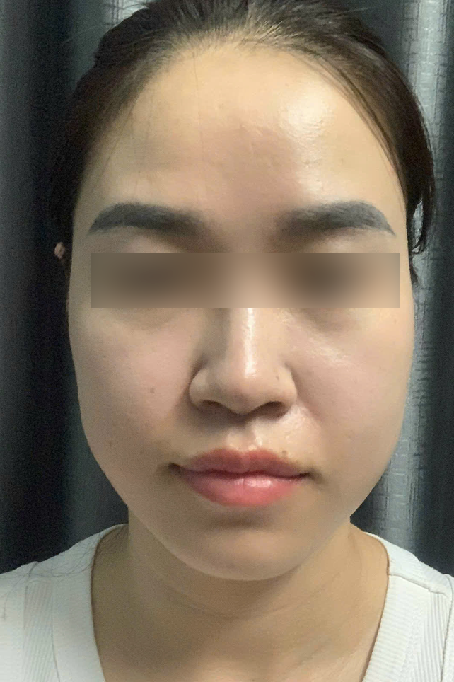 After Image