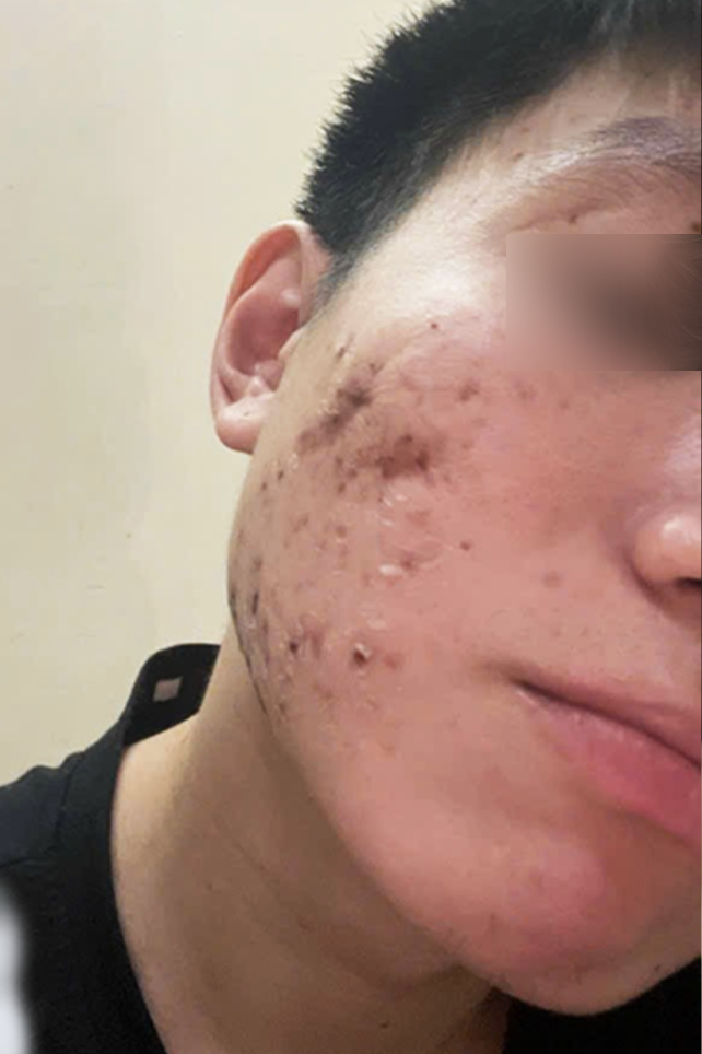 After Image